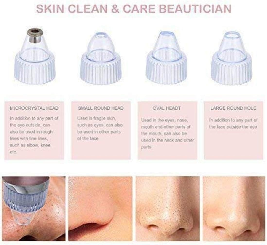 ๐โโ๏ธ Pore Cleaning Device โจ | Blackhead Remover Vacuum ๐ USB Rechargeable ๐