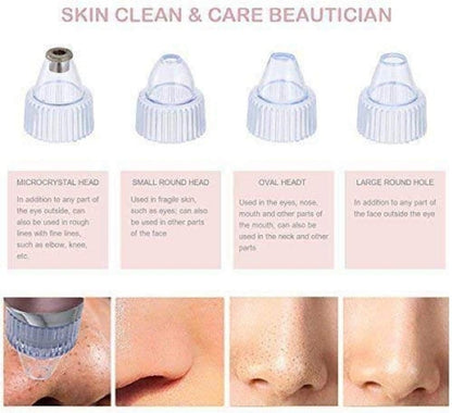 💆‍♀️ Pore Cleaning Device ✨ | Blackhead Remover Vacuum 🔋 USB Rechargeable 🌟